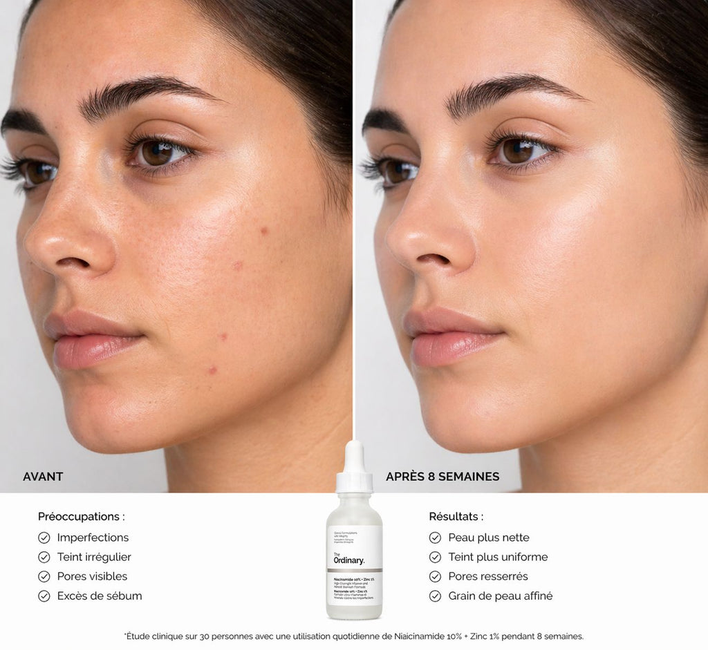 The Ordinary Niacinamide 10% + Zinc 1%
