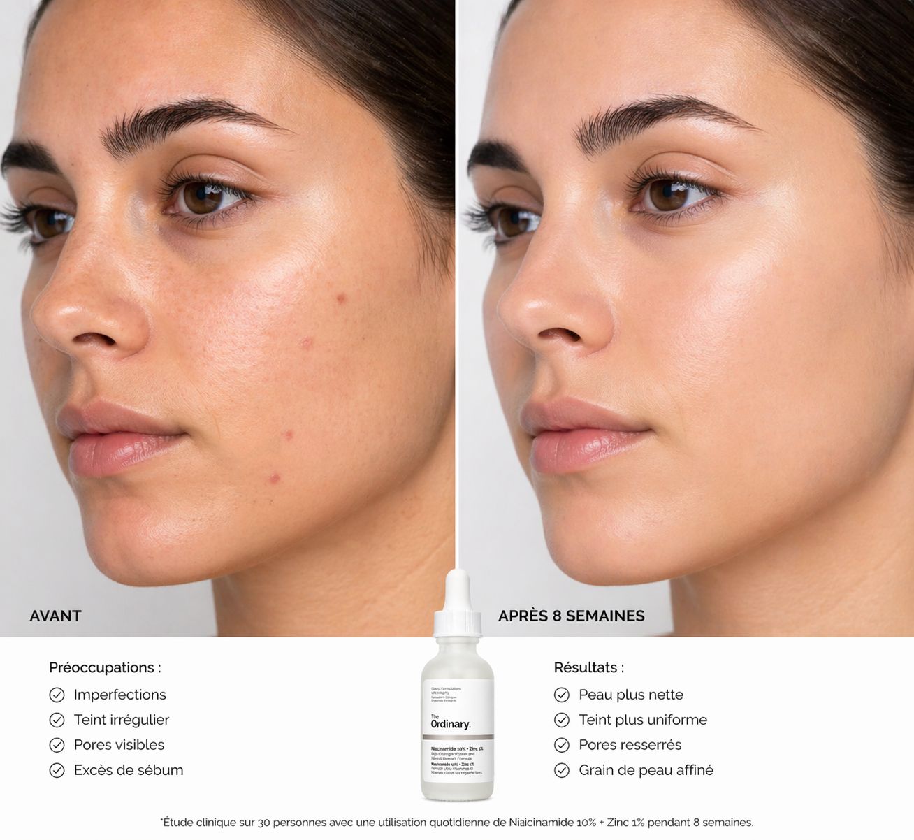 The Ordinary Niacinamide 10% + Zinc 1%